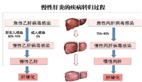 【健康科普】世界肝炎日——堅持早預防,加強檢測發(fā)現(xiàn),規(guī)范抗病毒治療